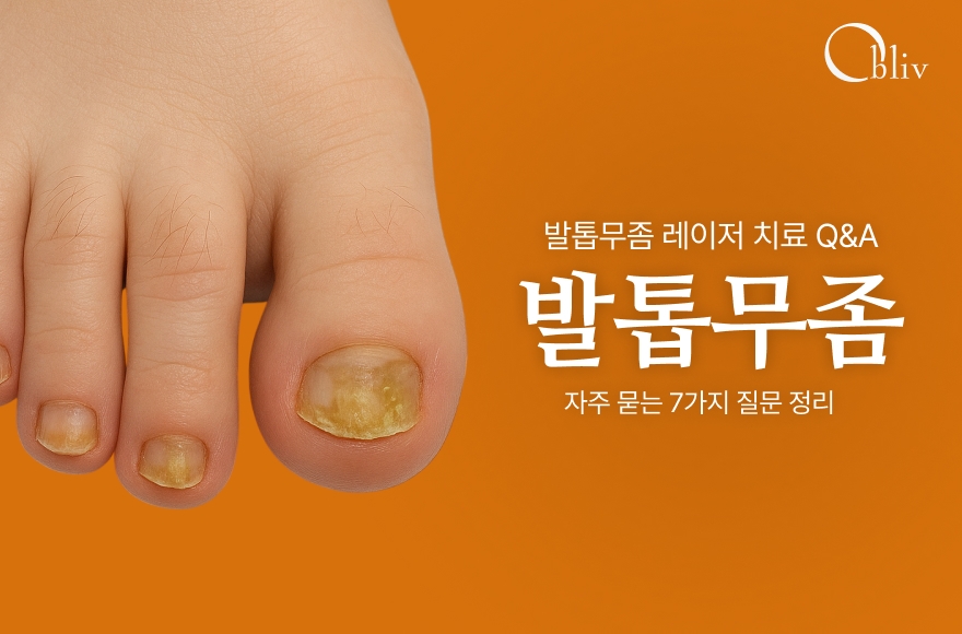발톱무좀 레이저 치료 Q&A: 자주 묻는 7가지 질문 정리