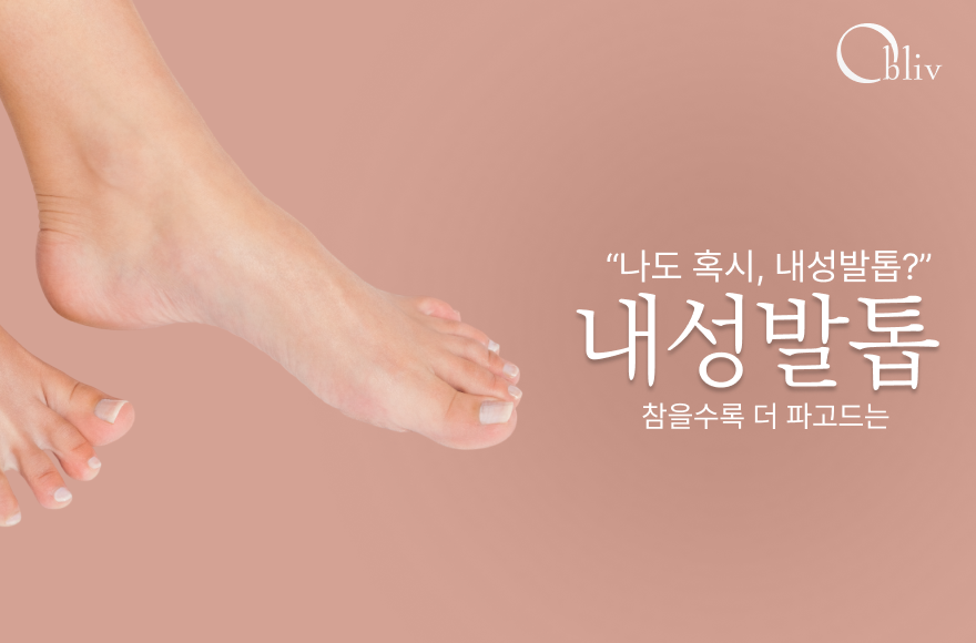 내성발톱, 자가치료 피해야 하는 이유_인천문제성발톱병원