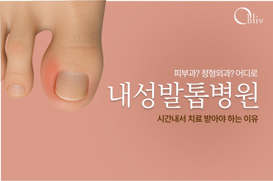 내성발톱 초기엔 어디로? 피부과 vs 정형외과 제대로 정리