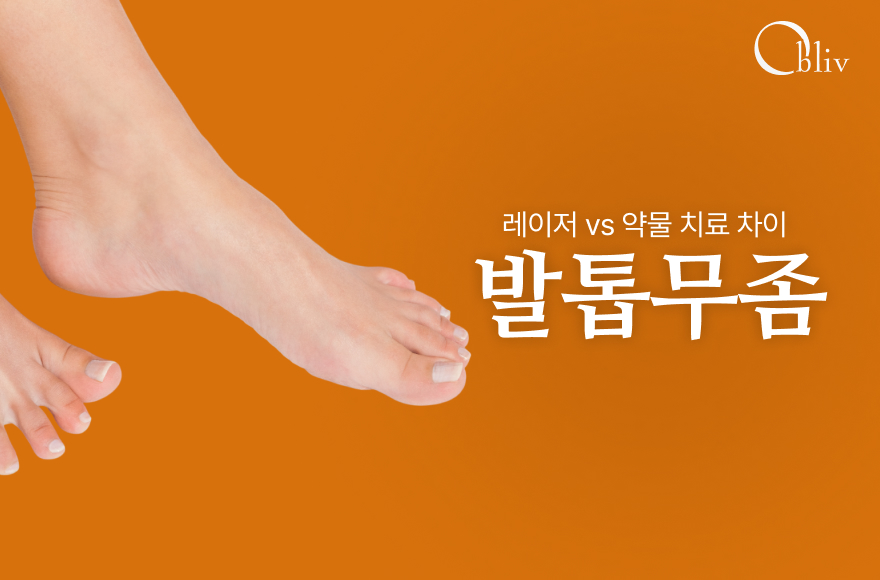송도발톱무좀 치료, 레이저 vs 약물 치료 어떤 차이가 있을까?