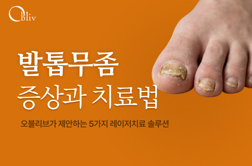발톱무좀 증상과 치료방법: 오블리브 5종 맞춤 레이저 치료 솔루션