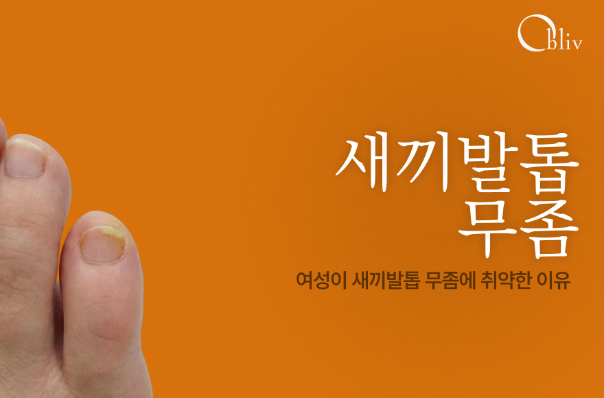 새끼발톱 무좀, 왜 여성에게 흔할까? 의학적 원인과 관리 가이드_인천송도발톱무좀병원