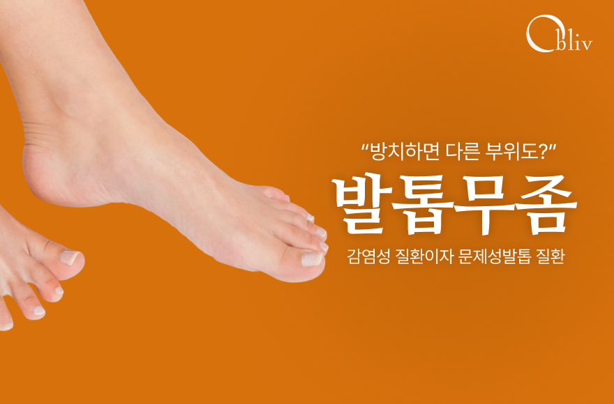 발톱무좀(조갑백선, 조갑진균증) 방치하면 더 커질 수 있는 문제성발톱 질환