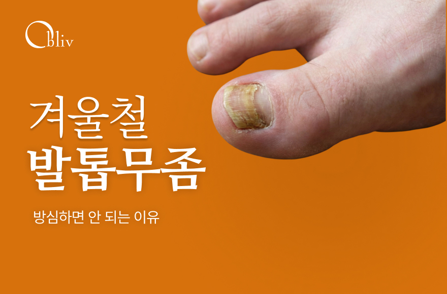 겨울이라 안심하셨나요? 발톱무좀 방심하면 안 되는 이유_송도발톱무좀