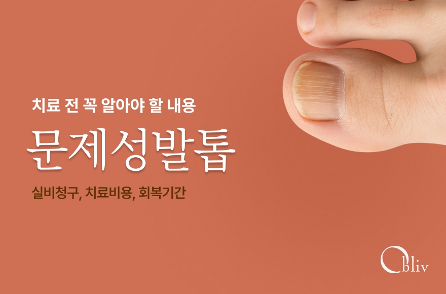 문제성발톱 치료 전 꼭 알아야 할 실비청구, 치료비용, 회복기간