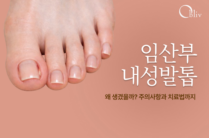 임산부내성발톱 왜 생겼을까? 주의사항⚠️ 예방부터 치료까지 A to Z