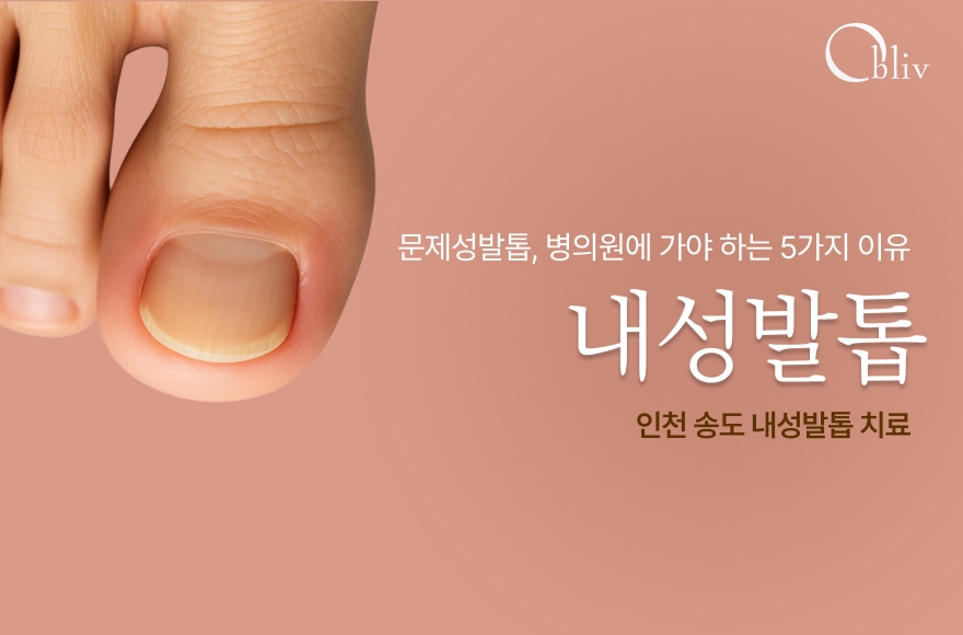 [인천 송도 내성발톱 치료] 문제성 발톱, 병원 가야 하는 5가지 이유